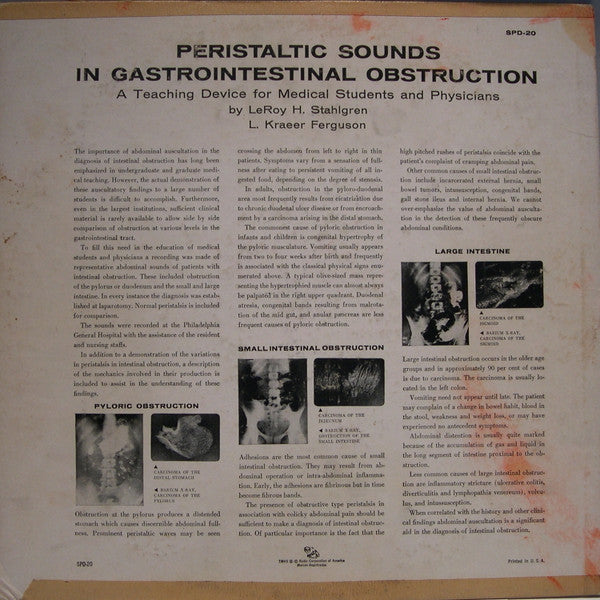 Peristaltic Sounds In Gastrointestinal Obstruction - A Teaching Device For Medical Students And Physicians - secondary